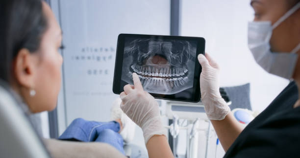 Licensed Tooth Extraction service in Emeryville, CA - Smile Center Dentistry